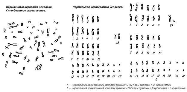C:\Папки рабочего стола\студентам\карио\рутина 1.jpg